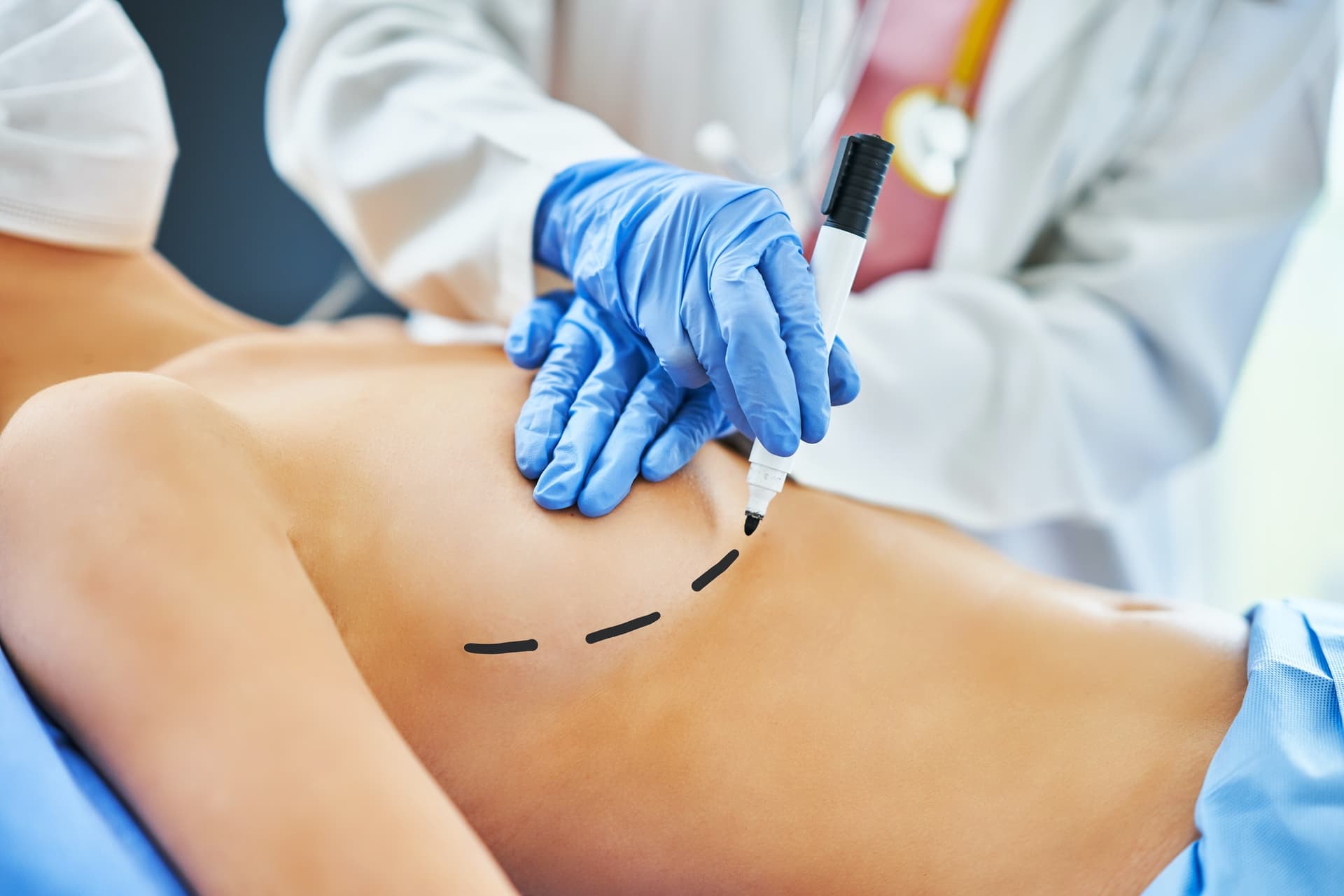 Brustvergrößerung mit Implantaten in Bochum – Ihr Körper, Ihre Entscheidung
